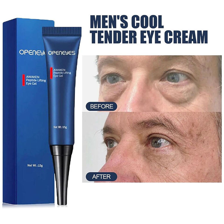 Openeyes Renewal Eye Cream – 33% OFF (Limited Time Only)