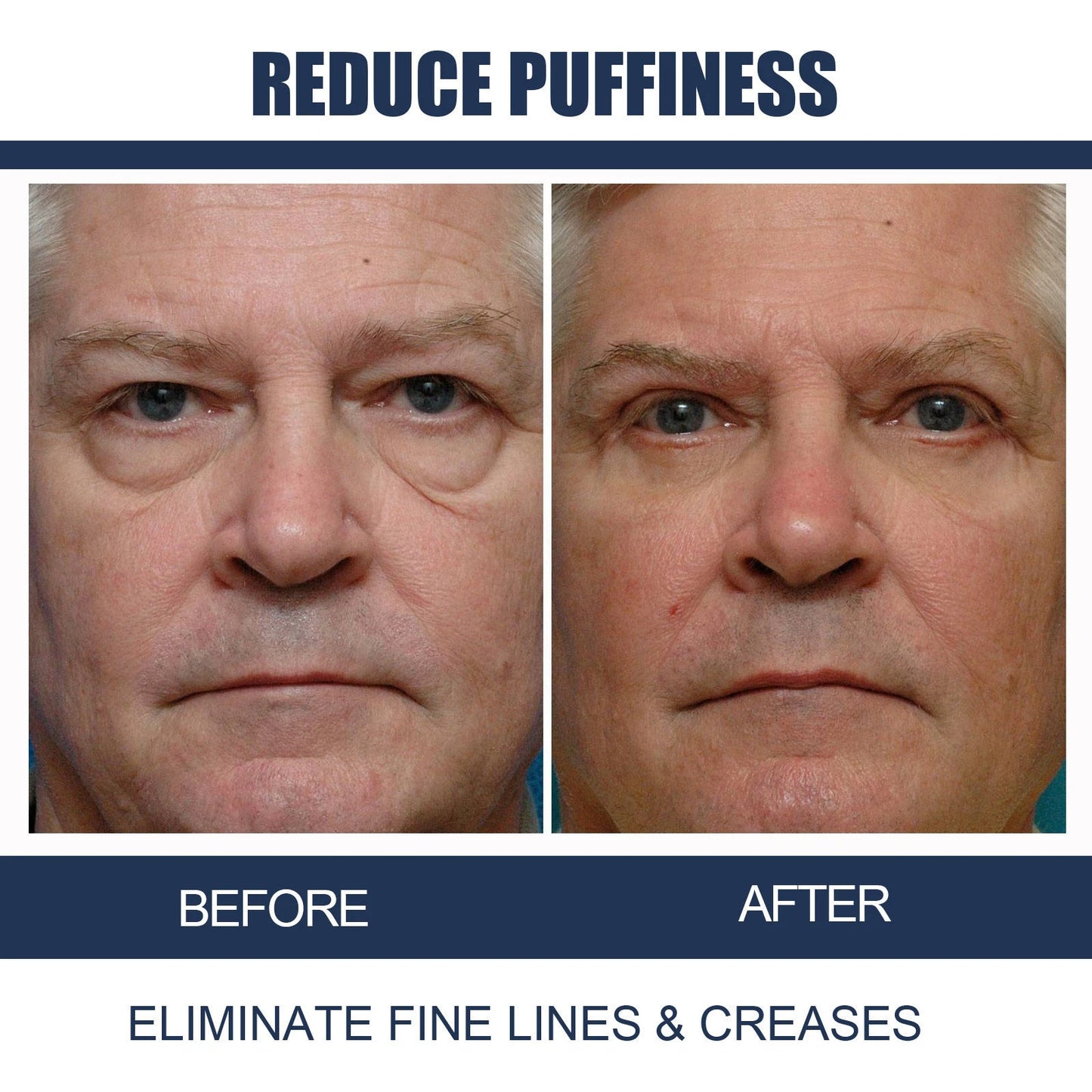 Openeyes Renewal Eye Cream – 33% OFF (Limited Time Only)