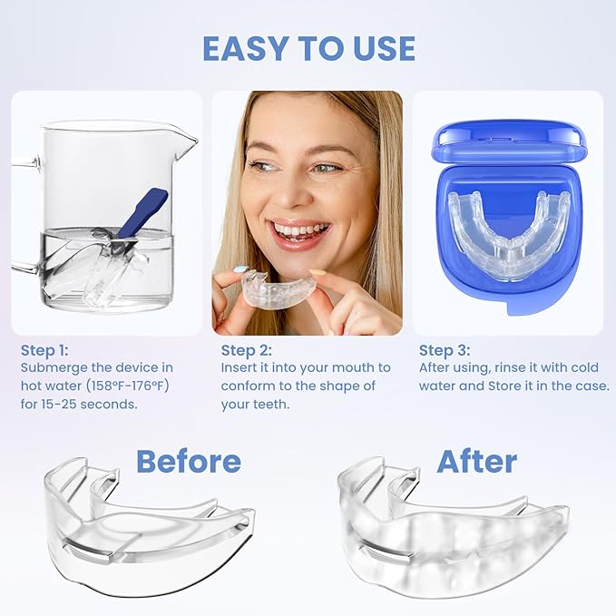 Magical Snoring Stopper – Sleep Silent Tonight (Limited Stock)