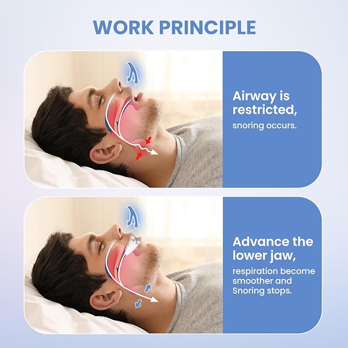 Magical Snoring Stopper – Sleep Silent Tonight (Limited Stock)