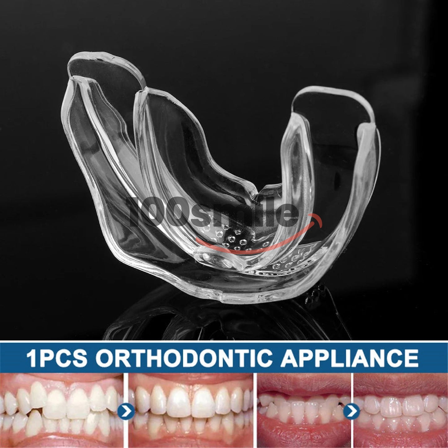Complete 3-Step Ultra Braces Set — Permanent Teeth & Jaw Alignment Solution - Limited Offer